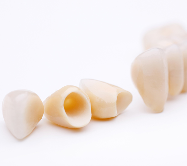 Potomac Dental Crowns and Dental Bridges