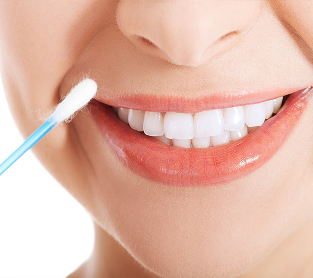 Potomac OralDNA Diagnostic Test