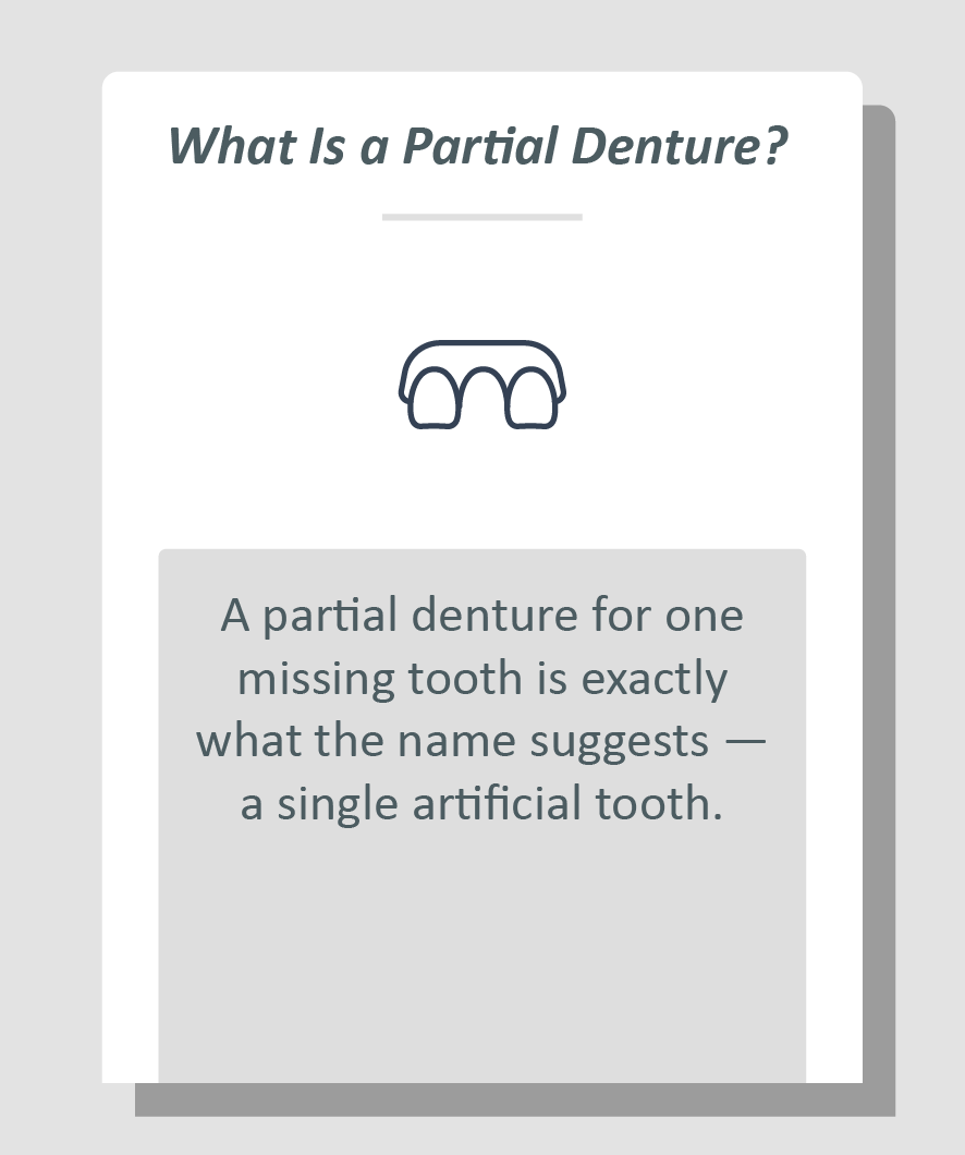 Partial denture for one missing tooth infographic: A partial denture for one missing tooth is exactly what the name suggests a single artificial tooth.